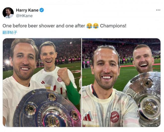 慶祝首冠，凱恩曬對(duì)比照。